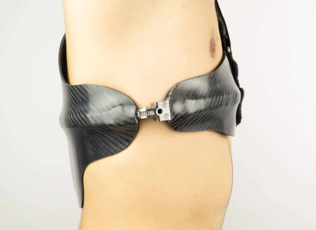 kielbrustorthese-seitlich-aus-carbon-saitätshaus-ergonomic care-münchen