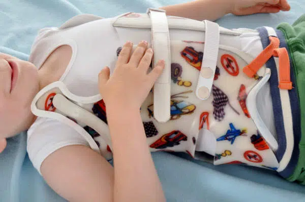 Wie wird Skoliose behandelt-Korsettbehandlung